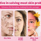 Silicone Ice Roller for Face Cooling Skin Care